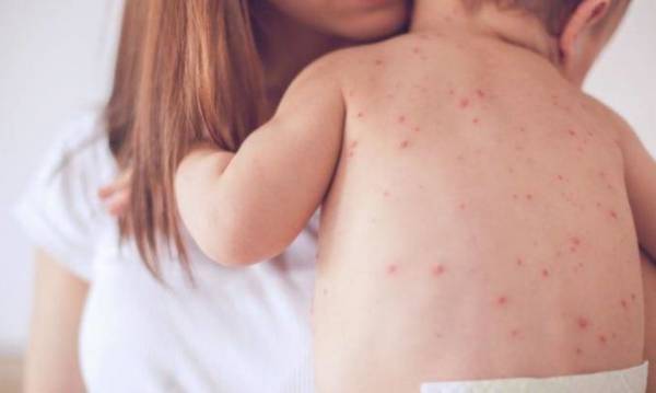 Κινητοποίηση για την επιδημική έξαρση της ιλαράς: Ήδη 5 επιβεβαιωμένα κρούσματα στην Μεσσηνία
