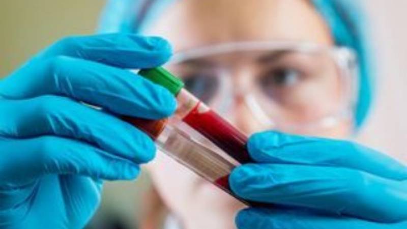 Νέο τεστ αίματος για τη διάγνωση της αλλεργίας στα φιστίκια