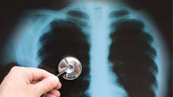 Αύξηση των θανάτων από φυματίωση παγκοσμίως-Δυσοίωνες οι προβλέψεις για τα επόμενα χρόνια