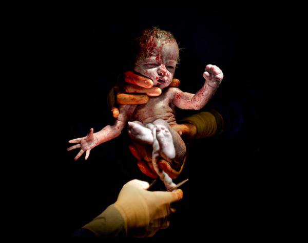 Εκπληκτικές φωτογραφίες μωρών λίγα δευτερόλεπτα μετά τη γέννηση