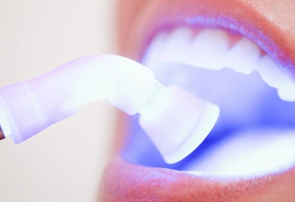 Επικίνδυνη για την υγεία η λεύκανση δοντιών εκτός οδοντιατρείου