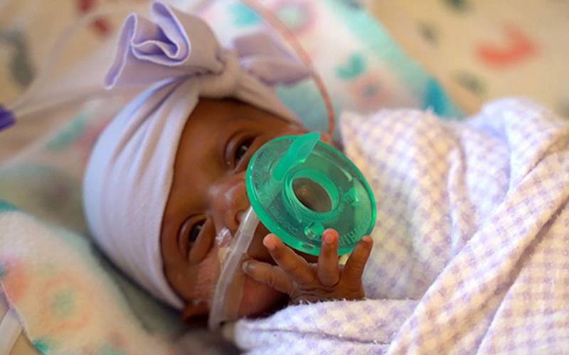 ΗΠΑ: Γεννήθηκε το μικρότερο μωρό του κόσμου - Μόλις 245 γραμμάρια (Βίντεο)