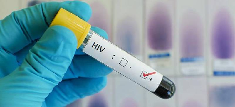 Έλεγχος ιικού φορτίου και στον ιδιωτικό τομέα για τους οροθετικούς με HIV